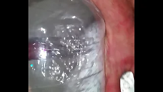 Fucking my beachball with a tube